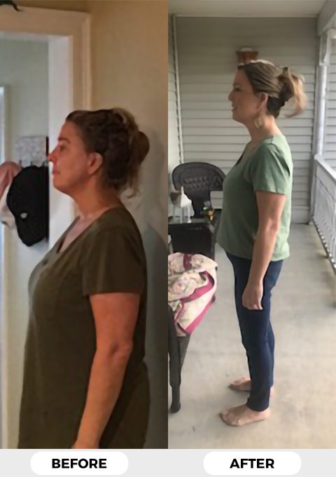 Deana_Burke_before_after Deane Burke before & after